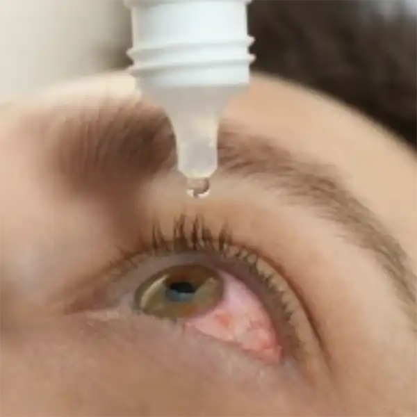 Eye Drops